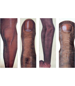 Magnification by artist Siddharth Soni